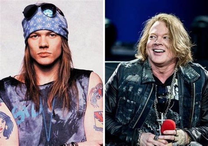 Axl Rose’s Plastic Surgery: The Guns N’ Roses Star Looks Unnatural!