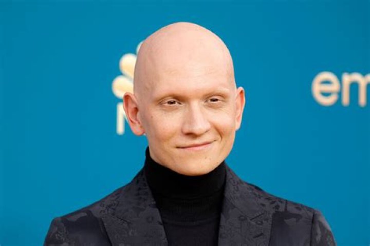Does Anthony Carrigan Have Cancer? Bald Hair Cause And Health Condition Update